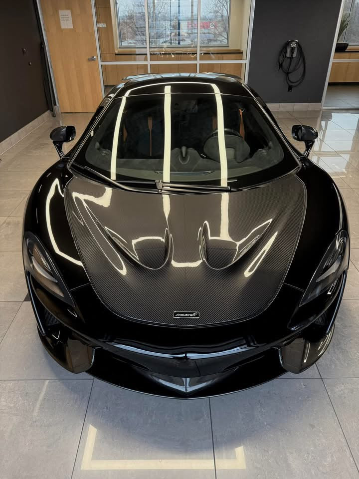 P1 Style Dry Carbon Fiber Hood for McLaren 570S/540C/570GT/600LT