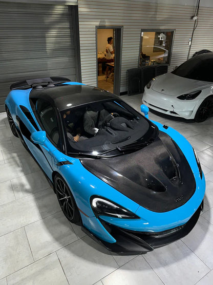 P1 Style Dry Double-Sided Carbon Fiber Hood for McLaren 570S/540C/570GT/600LT